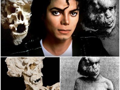 Michael Jackson’s DARK Obsession with The Elephant Man & Buying His Bones!